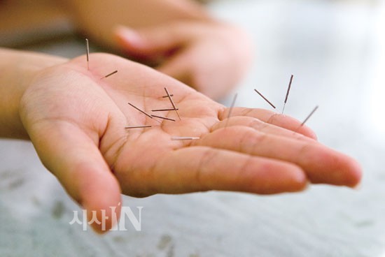 침·뜸을 둘러싼 진실 혹은 거짓 < 생활 < 기사본문 - 시사IN